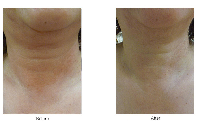 岐阜の美容院 ASHc-Lover ボディケア写真